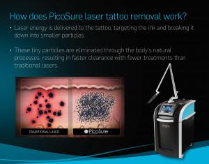  Long Pulse Nd Yag Laser Picosecond Laser Tattoo Removal Machine Ce Certificated Manufactures