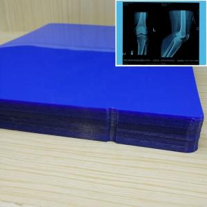  Agfa 5302 Blue XRay Film High Contrast Low Fog Level Manufactures