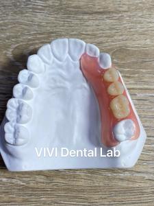 China High Esthetics Flexible Acrylic Partial Denture / Valplast Dental Partials on sale