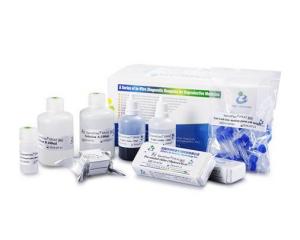 40 Tests / Kit SCD Method Sperm DNA Fragmentation Test Kit Wright Staining Dye Manufactures