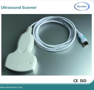 China hot sale digital usb ultrasound probe for laptop on sale