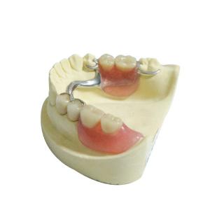 China CE Dental Lab Products Replacements Plastic Removable Partial Dentures on sale