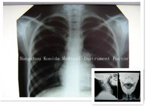 China Digital Medical X Ray Dry Film 14 x 17inch Health Imaging Radiographic Film on sale