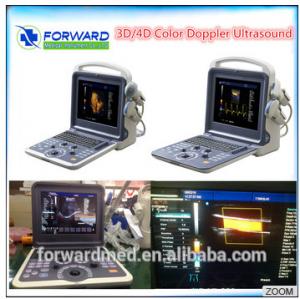  Vascular Doppler Ultrasound / Portable Ultrasound Color Doppler Manufactures
